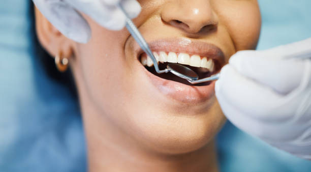 Emergency Dental Services in Bartlett, IL